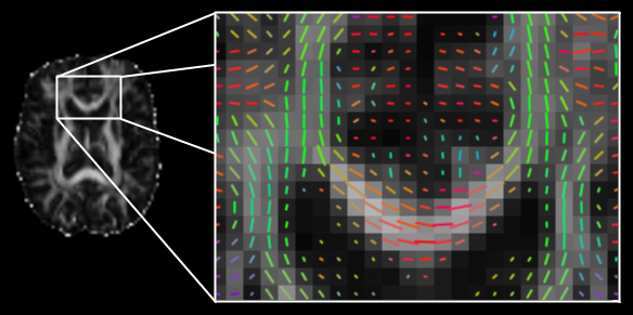 Diffusion principal directions