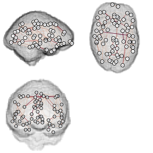 Graph shown topologically on brain