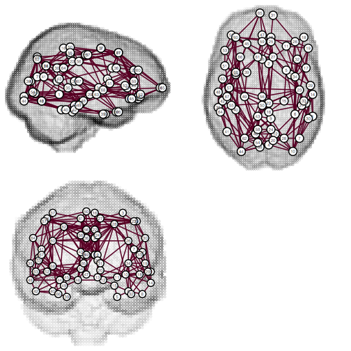 Morphological gradient of brain image