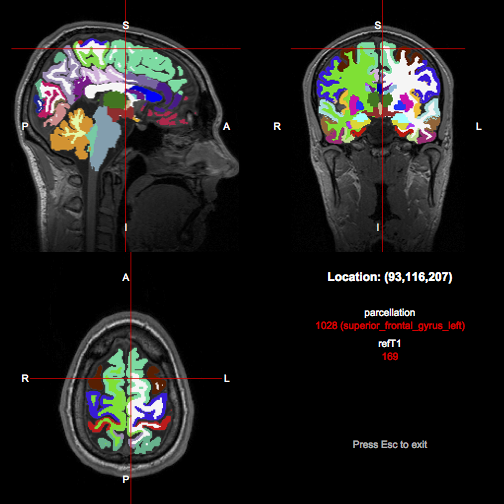 Parcellation overlaid on brain